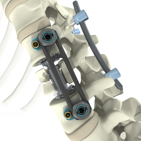 3D/Film - Animation - Medical Design - Aesculap - Spine Visuals - Beger Design - Wirbelsäulenimplantate