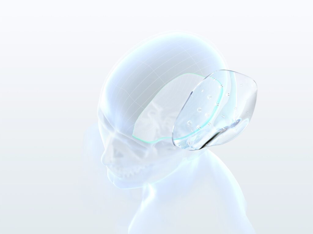 3D Visualisierung Kopfplatte